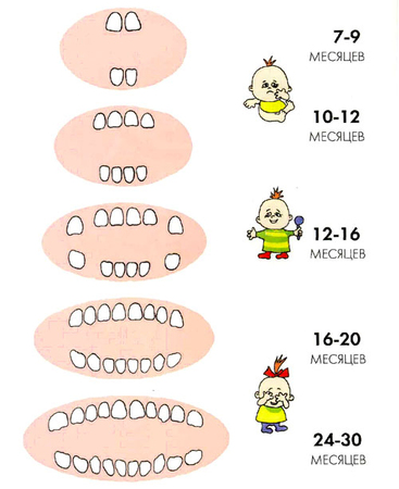 в каком порядке лезут зубы — 2 ответов на Babyblog