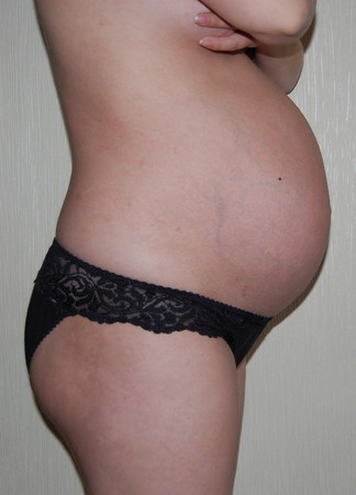 20 недель тянет низ живота. Животы беременных кривые. У беременной Кривой живот. Живот на 21 неделе. Живот стягивает при беременности.
