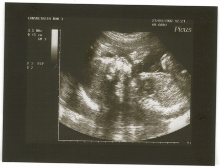 Беременность 37 Недель Фото Малыша