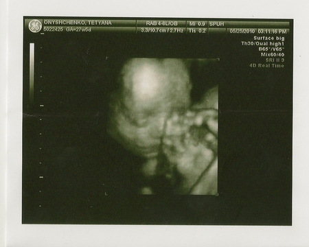 Узи 6 месяцев. Снимок УЗИ беременности 7 месяцев. УЗИ 7 месяцев беременности. Снимок УЗИ на 6 месяце мальчик.