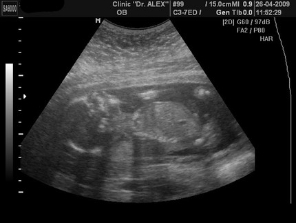 19 неделя беременности развитие и фото — Евромедклиник 24