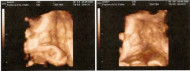 Фото УЗИ на 38 неделе беременности
