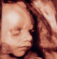 Фото УЗИ на 29 неделе беременности
