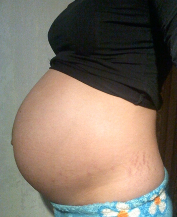 36 недель давит. Растяжки на животе беременность. Живот на 36 неделе беременности. Живот беременной с растяжками.