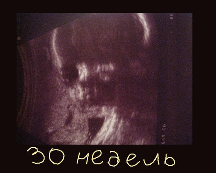 Беременность 30 недель отзывы