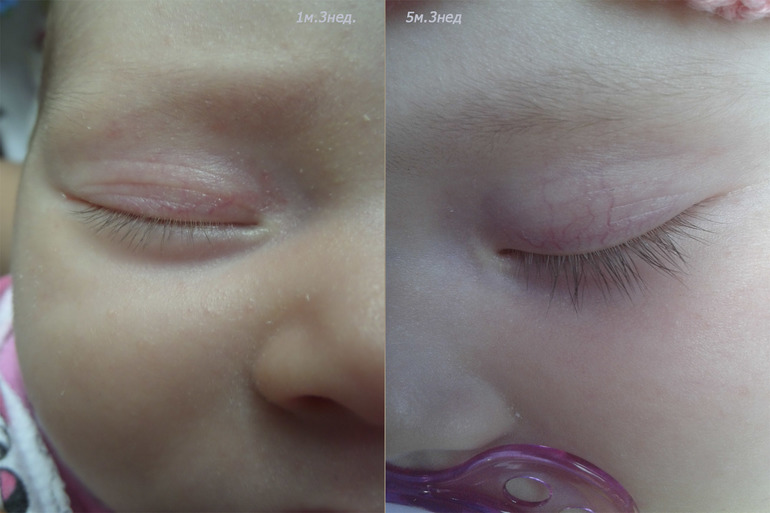 Заболела. 5/25